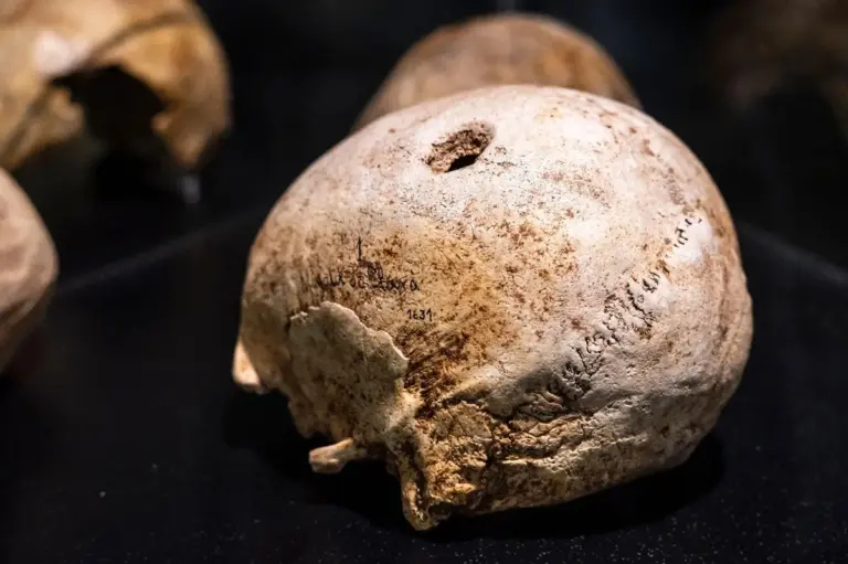How Incas Performed Brain Surgery Without Anesthesia 500 Years Ago